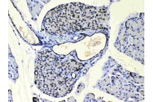 IHC analysis of COPE using anti-COPE antibody . (COPE anticorps  (AA 80-308))