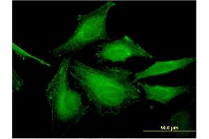 Immunofluorescence of monoclonal antibody to HSFY2 on HeLa cell.
