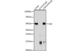 Immunoprecipitation analysis of 200 μg extracts of Jurkat cells using 3 μg SSB antibody (ABIN3015264, ABIN3015265, ABIN3015266 and ABIN6213909).
