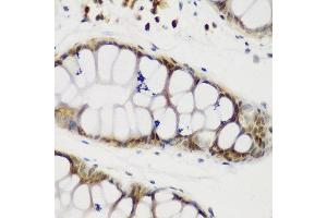 Immunohistochemistry of paraffin-embedded human gastric using NCL antibody at dilution of 1:200 (40x lens). (Nucleolin anticorps)