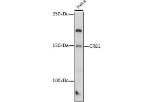 Western blot analysis of extracts of HeLa cells, using CRB1 antibody (ABIN7266524) at 1:1000 dilution. (CRB1 anticorps  (AA 20-200))