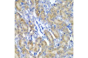 Immunohistochemistry of paraffin-embedded rat kidney using CRYAA antibody at dilution of 1:200 (40x lens). (CRYAA anticorps)