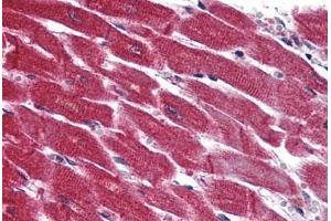 Anti-EDG3 / S1P3 antibody  ABIN1048532 IHC staining of human heart. (S1PR3 anticorps  (N-Term))