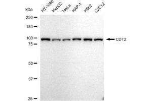 Western blotting analysis using CDT2 antibody (ABIN7798307).