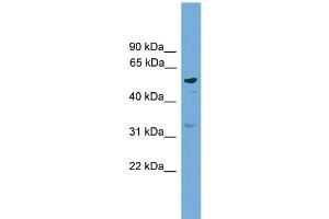 WB Suggested Anti-RSAD1  Antibody Titration: 0.