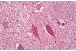 Anti-GRIN1 / NMDAR1 antibody IHC staining of human brain, cortex neurons.