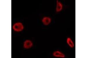 ABIN6275805 staining Hela by IF/ICC.