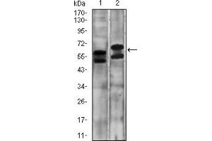 Fig. (CA9 anticorps  (AA 37-186))
