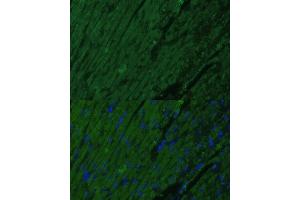 Immunofluorescence analysis of mouse heart cells using TNNI3 antibody (ABIN6132730, ABIN6149358, ABIN6149360 and ABIN6222761) at dilution of 1:100.