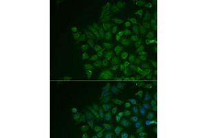Immunofluorescence analysis of MCF7 cells using LRat Polyclonal Antibody (LRAT anticorps)