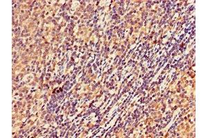 IHC image of ABIN7168978 diluted at 1:300 and staining in paraffin-embedded human lymph node tissue performed on a Leica BondTM system. (DRAK2 anticorps  (AA 235-366))