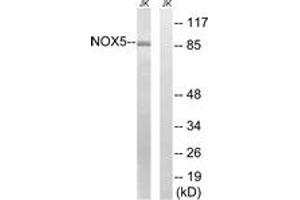 Western blot analysis of extracts from Jurkat cells, using NOX5 Antibody. (NOX5 anticorps  (AA 677-726))