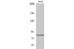 Western Blotting (WB) image for anti-Lipase, Hormone-Sensitive (LIPE) (Ser774) antibody (ABIN3185095) (LIPE anticorps  (Ser774))