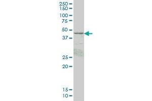 PRKAR1B monoclonal antibody (M05), clone 1F8 Western Blot analysis of PRKAR1B expression in HepG2 .