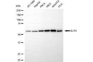Western blotting analysis using ELP3 antibody (ABIN7798434).