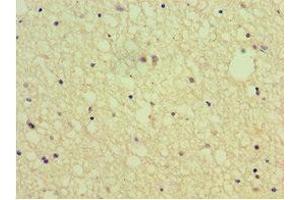 Immunohistochemistry of paraffin-embedded human brain tissue using ABIN7168802 at dilution of 1:100 (SEMA4C anticorps  (AA 749-833))