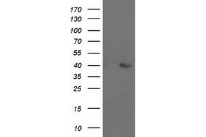 Western Blotting (WB) image for anti-Aldolase B, Fructose-Bisphosphate (ALDOB) antibody (ABIN1496606) (ALDOB anticorps)