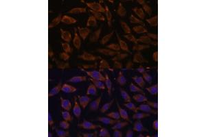Immunofluorescence analysis of L929 cells using NOTCH2 antibody (ABIN6132419, ABIN6144736, ABIN6144737 and ABIN6213887) at dilution of 1:100.