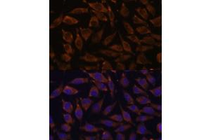 Immunofluorescence analysis of L929 cells using NOTCH2 antibody (ABIN6132419, ABIN6144736, ABIN6144737 and ABIN6213887) at dilution of 1:100. (NOTCH2 anticorps  (AA 2242-2471))
