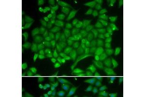Immunofluorescence analysis of MCF-7 cells using RAB11A Polyclonal Antibody (RAB11A anticorps)