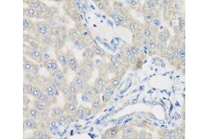 Immunohistochemistry of paraffin-embedded Rat liver using PYCR1 Polyclonal Antibody at dilution of 1:200 (40x lens). (PYCR1 anticorps)
