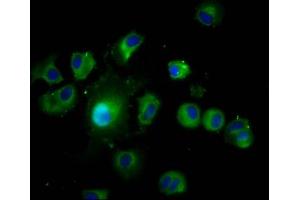 Immunofluorescence staining of MCF-7 cells with ABIN7167068 at 1:200, counter-stained with DAPI. (LAMTOR1 anticorps  (AA 2-161))