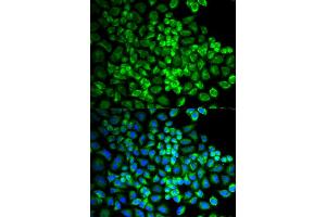 Immunofluorescence analysis of U2OS cells using GRIA3 antibody (ABIN5970505).