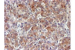 Image no. 3 for anti-NADH Dehydrogenase (Ubiquinone) Complex I, Assembly Factor 7 (NDUFAF7) antibody (ABIN1499667) (NDUFAF7 anticorps)