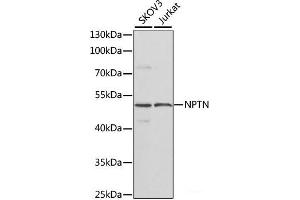 Western blot analysis of extracts of various cell lines using NPTN Polyclonal Antibody at dilution of 1:1000. (NPTN anticorps)