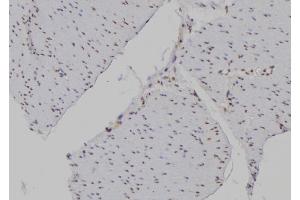 ABIN6277194 at 1/100 staining Human gastric tissue by IHC-P. (Histone 3 anticorps  (H3K4me3))