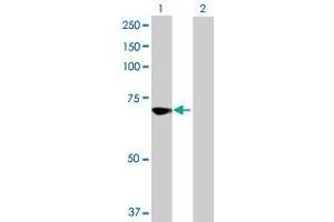 Lane 1: CPT2 transfected lysate ( 73. (CPT2 293T Cell Transient Overexpression Lysate(Denatured))