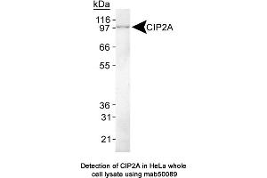 Image no. 1 for anti-KIAA1524 (KIAA1524) (C-Term) antibody (ABIN363243) (KIAA1524 anticorps  (C-Term))