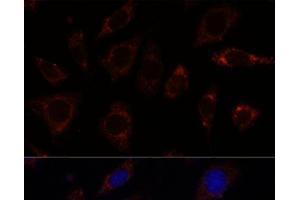 Immunofluorescence analysis of L929 cells using TBRG4 Polyclonal Antibody at dilution of 1:100. (TBRG4 anticorps)