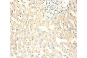 Immunohistochemistry of paraffin-embedded human liver tissue using ABIN7159537 at dilution of 1:100 (MT1X anticorps  (AA 1-59))