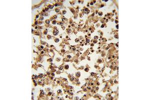 Immunohistochemistry (IHC) image for anti-Ets Variant 6 (ETV6) antibody (ABIN3003964)