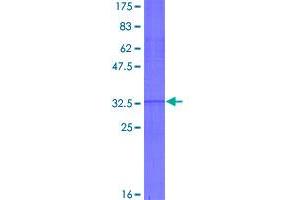 Image no. 1 for Homeobox A5 (HOXA5) (AA 171-270) protein (GST tag) (ABIN1306933)