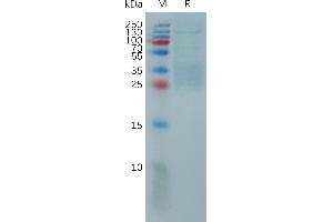 Human IL9 Protein, His Tag on SDS-PAGE under reducing condition.
