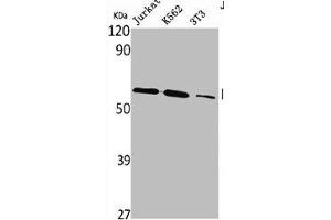 Western Blot analysis of Jurkat K562 NIH-3T3 cells using PLK-5 Polyclonal Antibody (PLK5 anticorps  (Internal Region))