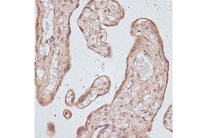 Immunohistochemistry of paraffin-embedded human placenta using TLK1 antibody (ABIN7270859) at dilution of 1:100 (40x lens).