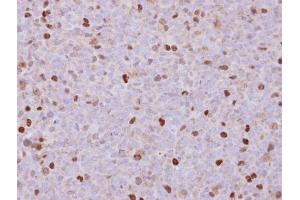 IHC-P Image Immunohistochemical analysis of paraffin-embedded H1299 xenograft , using RACGAP1, antibody at 1:500 dilution.
