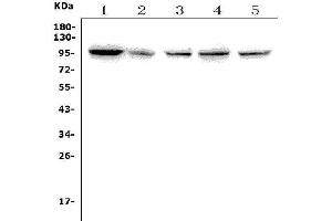 Western blot analysis of TTK using anti-TTK antibody (ABIN7601844).