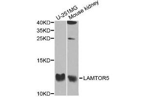 Western blot analysis of extracts of various cell lines, using LAMTOR5 antibody. (HBXIP anticorps  (AA 1-173))