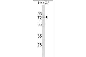 ZN Antibody (Center) (ABIN1537955 and ABIN2849970) western blot analysis in HepG2 cell line lysates (35 μg/lane). (ZNF614 anticorps  (AA 174-200))