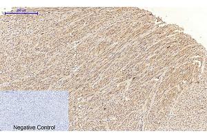 Immunohistochemical analysis of paraffin-embedded human uterus tissue. (JNK anticorps  (pThr183))