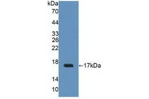 Western blot analysis of recombinant Human UPK2. (Uroplakin 2 anticorps  (AA 26-153))