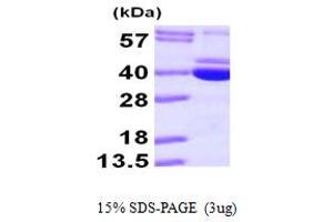 Pyridoxal Kinase (PDXK) (AA 1-312) protein (His tag)