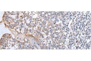 Immunohistochemistry of paraffin-embedded Human tonsil tissue using GPD2 Polyclonal Antibody at dilution of 1:40(x200) (GPD2 anticorps)