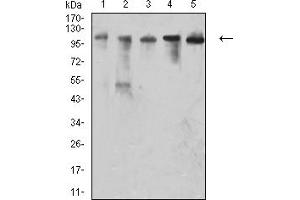 Western blot analysis using CD106 mouse mAb against EC (1), COS7 (2), MCF-7 (3), HepG2 (4), and Hela (5) cell lysate.