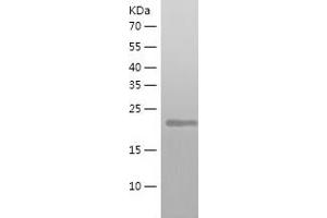 Western Blotting (WB) image for Autophagy Related 10 (ATG10) (AA 1-220) protein (His tag) (ABIN7121949)
