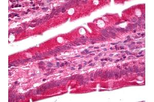 Anti-GUCY1A3 / Guanylyl Cyclase Alpha 1 antibody IHC of human small intestine. (GUCY1A1 anticorps)